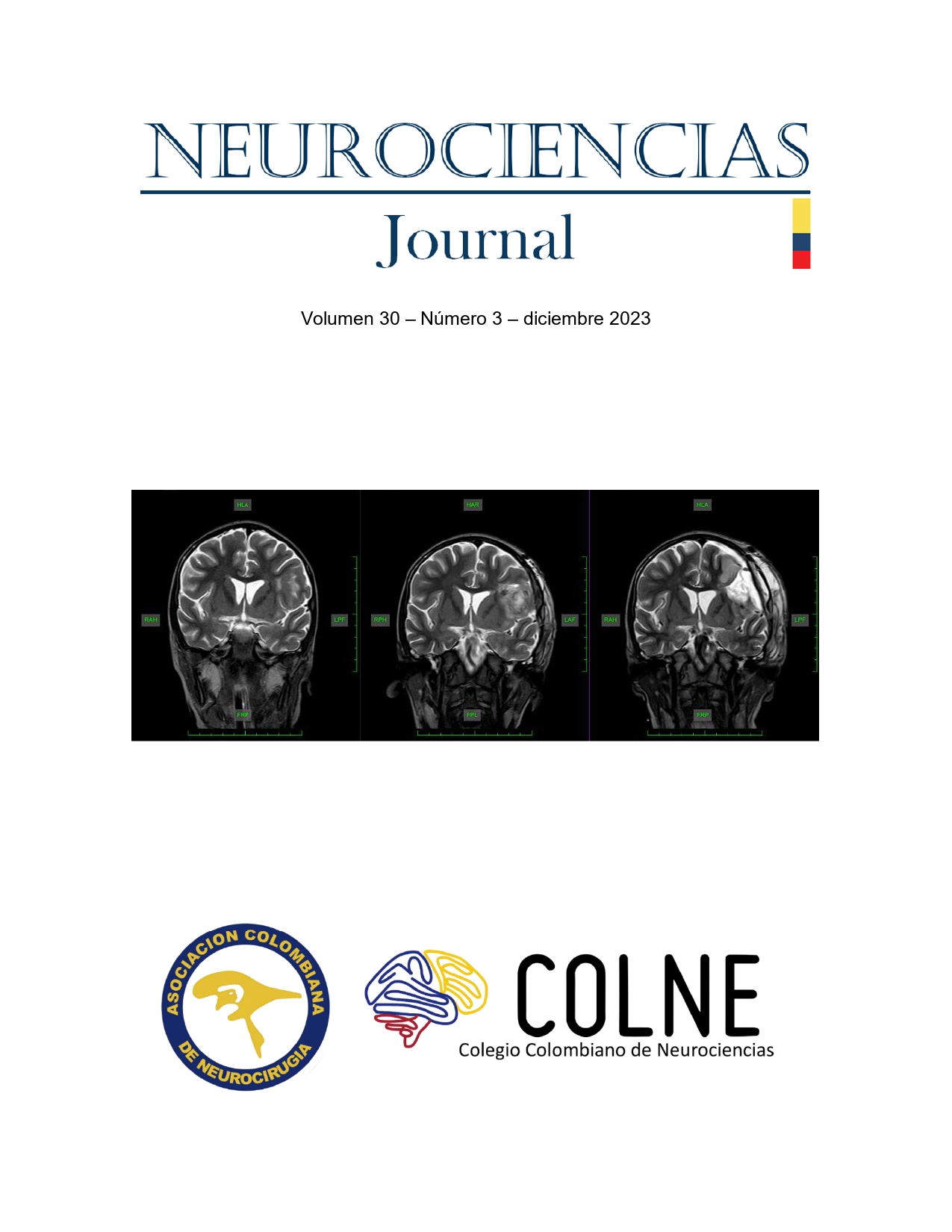 					Ver Vol. 30 Núm. 3 (2023): Neurociencias Journal
				